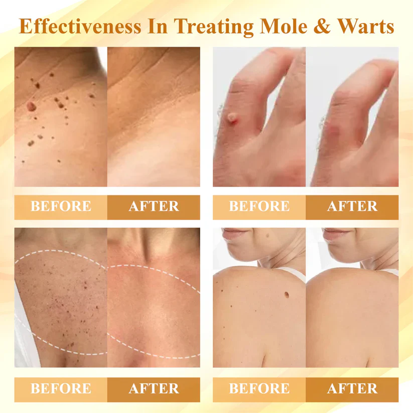 Cvreoz® Condense Mellifera Venom Skin Repairing Cream 3 Cvreoz® Condense Mellifera Venom Skin Repairing Cream