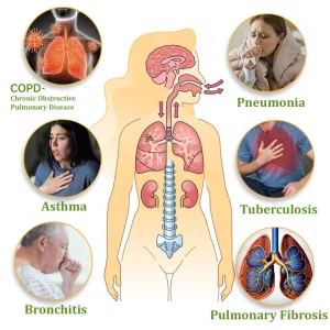 Zvoevo® NAC-Enhanced Lung Cleansing Inhaler