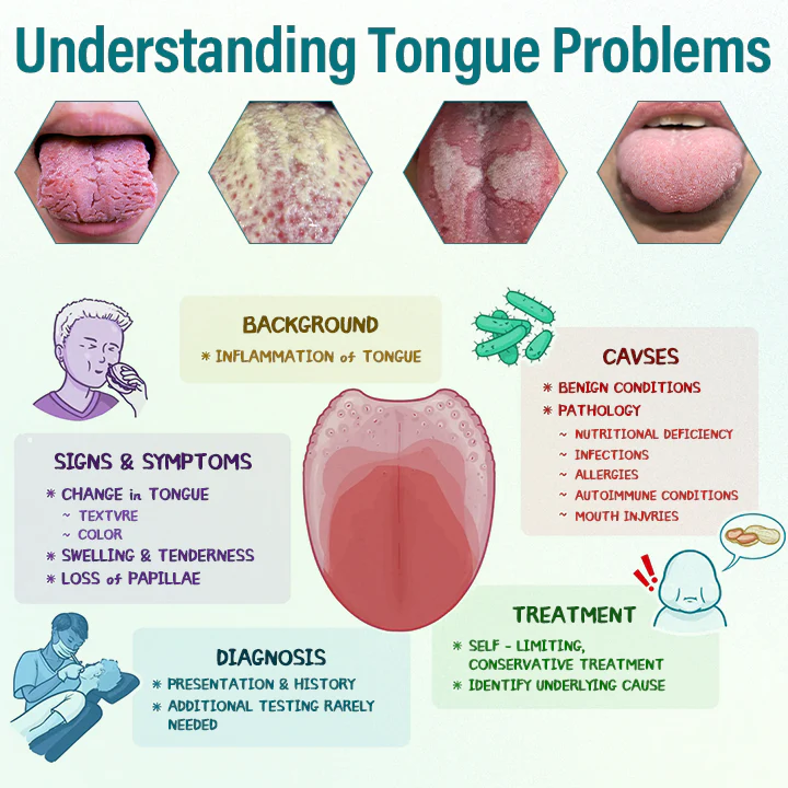 Timilk® GlosShield Tongue Repair Spray 4 Timilk® GlosShield Tongue Repair Spray