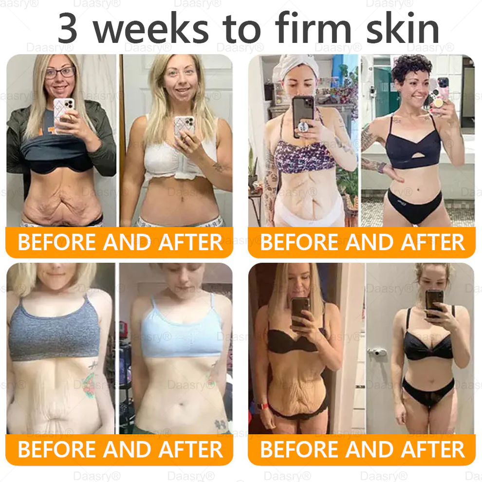 Daasry® Bee Venom Treatment Cream 6 Daasry® Bee Venom Treatment Cream - Image 6