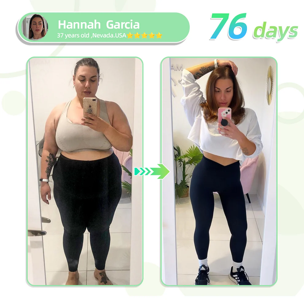 BBOJI™ SMGT-GLP-1 Nano Microneedle Patch 2 BBOJI™ SMGT-GLP-1 Nano Microneedle Patch