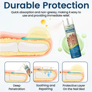 Timilk® OnyxiGuard Fungal Repair Herbal Spray 11 Timilk® OnyxiGuard Fungal Repair Herbal Spray