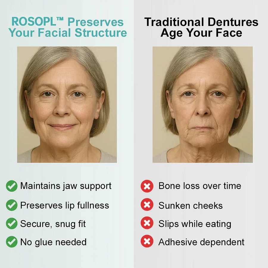 ROSOPL™ Advanced Customized Full Denture Set 9 ROSOPL™ Advanced Customized Full Denture Set - Image 9