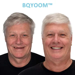 BQYOOM™ Dentures | Invisible Comfort, Natural Grip 13 BQYOOM™ Dentures | Invisible Comfort, Natural Grip