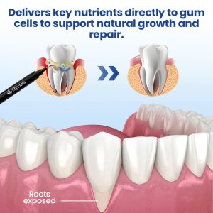 Elycura™ Gum Care Solution | Finally—A Non-Surgical Solution 7 Elycura™ Gum Care Solution | Finally—A Non-Surgical Solution
