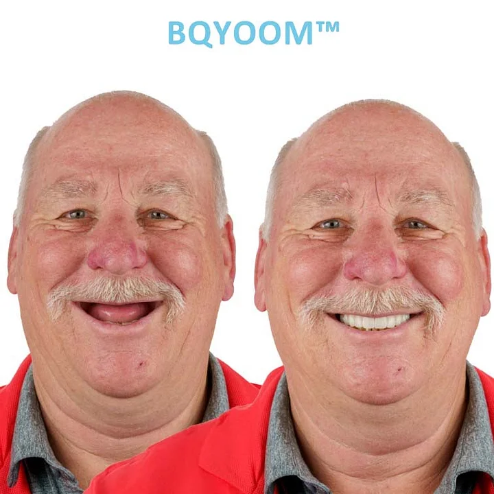 BQYOOM™ Dentures | Invisible Comfort, Natural Grip 3 BQYOOM™ Dentures | Invisible Comfort, Natural Grip