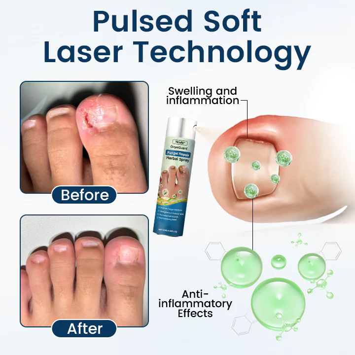 Timilk® OnyxiGuard Fungal Repair Herbal Spray 5 Timilk® OnyxiGuard Fungal Repair Herbal Spray - Image 5