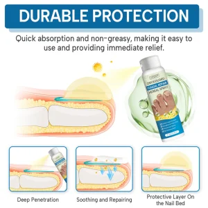 Lyyeto® OnyxiGuard Fungal Repair Herbal Spray ACE 12 Lyyeto® OnyxiGuard Fungal Repair Herbal Spray ACE