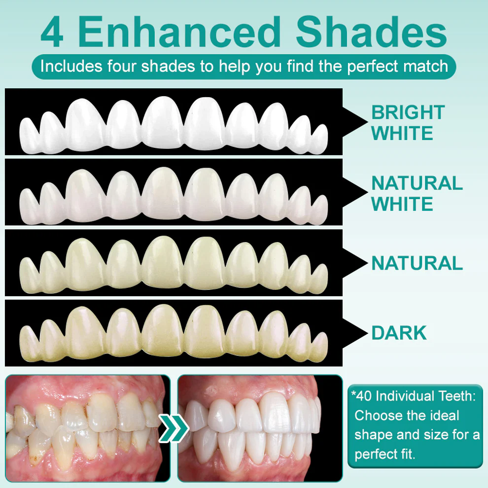 Ourlyard® Instant Stick on Dental Veneers 5 Ourlyard® Instant Stick on Dental Veneers