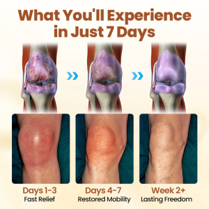 Caselast® Premium Curcumin Pain Relief Gel