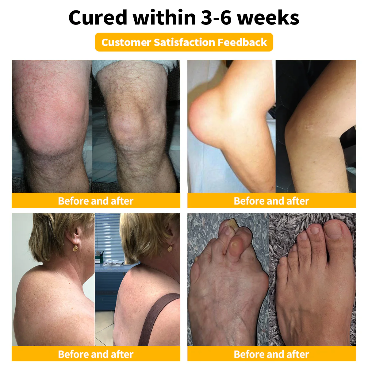 LOVILDS™ Bee Venom Joint Repair Cream 4 LOVILDS™ Bee Venom Joint Repair Cream - Image 4