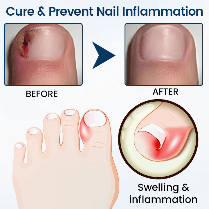 Timilk® OnyxiGuard Fungal Repair Herbal Spray 6 Timilk® OnyxiGuard Fungal Repair Herbal Spray - Image 6