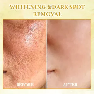 Fivfivgo Revitalizing Oil For Skin Tightening