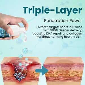 Cvreoz® Advanced Scar Gel – Reveal Smooth, Healthier Skin Fast