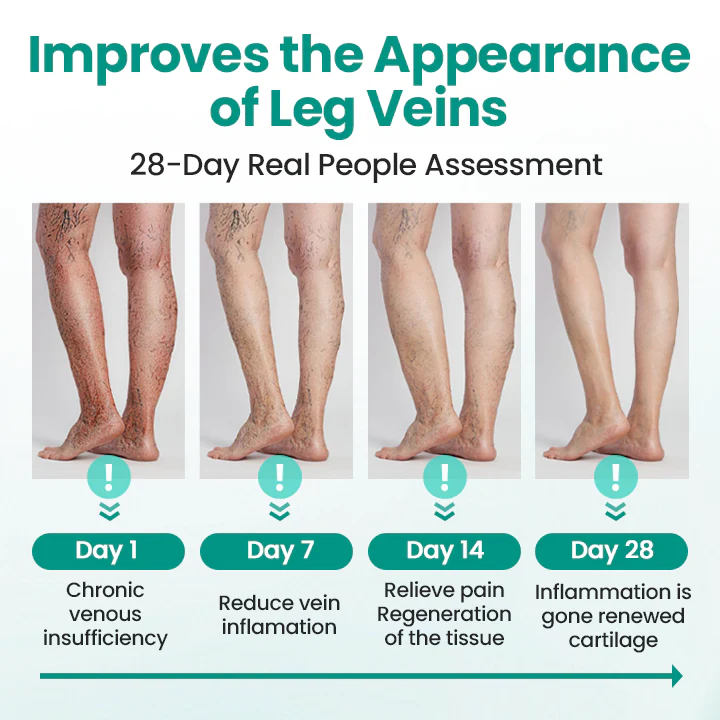 Naturbelassen® Leg Renew Patch 3 Naturbelassen® Leg Renew Patch Improve vein health and banish varicose veins with Naturbelassen® LegRenew Patch—no surgery needed! Naturbelassen® LegRenew Varicose Veins Patch is an advanced, non-invasive solution to reduce the appearance of varicose veins and improve overall vein health. Packed with anti-inflammatory and antioxidant nutrients, it boosts circulation, soothes irritation, and strengthens vein walls and valves, all while alleviating discomfort and swelling—right from the comfort of your home. Real User Testimonials "I noticed a huge difference in just two weeks!" "I've been self-conscious about my legs for years, but these patches are a total game changer. They're so comfortable to wear, and I actually started seeing my veins fade after the first week. I finally feel hopeful about my legs again." — Lisa T "No more aching legs by the end of the day!" "I work in retail and spend over eight hours a day on my feet. It’s exhausting, and my legs used to ache so badly. Since using these patches, the swelling and pain have gone down noticeably. Plus, they’re super easy to use—I just stick them on, and they do their thing." — Diane M "Why didn’t I find this sooner?" "I used to avoid wearing shorts all the time because I felt so self-conscious about my legs. Now, I actually feel confident again! It’s amazing how simple it is—I just wear the patch while I sleep, and I’ve seen incredible changes. Highly recommend it!" — Margaret S Understanding Varicose Veins: Causes and Effects Varicose veins are swollen, twisted veins that often appear on the legs and feet. They happen when the tiny valves in your veins, which keep blood flowing to your heart, become weak or damaged. This causes blood to collect in the veins, making them bulge and become visible as blue or purple lines under the skin. While they may seem like just a cosmetic issue, varicose veins can cause discomfort, heaviness, swelling, and even pain. In some cases, they can lead to skin discoloration or inflammation. Common causes include aging, genetics, pregnancy, hormonal changes, obesity, prolonged sitting or standing, and lack of exercise. Women are more likely to develop them, especially as they age. Symptoms of Varicose Veins Swelling in the legs or ankles A feeling of heaviness, pain, warmth, or tingling in the legs Visible veins that are blue or purple, often twisted or bulging Many people experience leg pain, swelling, and fatigue from varicose veins, which can disrupt daily activities and significantly reduce their quality of life. How Does the Naturbelassen® LegRenew Varicose Veins Patch Work? The Naturbelassen®LegRenew Varicose Veins Patch uses microneedling technology to create tiny skin micro-channels, ensuring deeper absorption of active ingredients. This boosts blood flow, relaxes veins, and enhances circulation for fast relief. Its anti-inflammatory properties reduce swelling while promoting vein repair, tissue regeneration, and elasticity improvement. Advanced Microneedle Technology, Easy as a Patch Each ultra-thin patch contains hundreds of microscopic needles made from skin-safe ingredients. These microneedles: Penetrate the top layer of skin (painlessly!) Deliver healing plant extracts like Safflower, Honeysuckle & Astragalus Help reduce inflammation, boost blood flow, and break up discoloration Reduce Swelling and Discomfort The Naturbelassen®LegRenew Varicose Veins Patch provides an effective solution for managing discomfort caused by varicose veins. Regular use helps alleviate inflammation, pain, redness, and heat by addressing the root issues. Its specialized formula includes ingredients that constrict blood vessels, improving blood flow and preventing pooling. This reduces swelling and offers lasting relief from edema. Boost Blood Circulation Designed to enhance overall vein health, the Naturbelassen®LegRenew Varicose Veins Patch contains active ingredients that stimulate blood flow in affected areas. When applied, it works to expand blood vessels, promoting circulation and reducing congestion. By supporting vascular health, it improves blood flow for stronger, healthier veins. Enhance Skin Appearance The Naturbelassen®LegRenew Varicose Veins Patch is an excellent choice for addressing visible vein concerns such as dilated capillaries, bruising, or telangiectasia. Infused with natural herbal extracts, this gentle yet effective formula significantly enhances the appearance of varicose veins, leaving your skin healthier and smoother. The patch’s innovative design offers immediate comfort and long-term support, making it a convenient and effective solution for improving vein health and circulation. Clinically Proven: Transforming Vein Health with Naturbelassen® LegRenew As a dermatologist, I’ve seen how frustrating it can be for patients with varicose veins when traditional treatments don’t work. Many want a safe, natural way to manage symptoms and improve vein health, which led me to create the Naturbelassen® LegRenew Varicose Veins Patch. For over five years, it has helped thousands improve circulation, reduce swelling, and ease discomfort. Made with premium natural ingredients, Naturbelassen® LegRenew provides a non-invasive option to support vein health, restore comfort, and boost confidence. It’s been rewarding to witness how Naturbelassen® LegRenew has transformed so many lives. Why Choose Naturbelassen®LegRenew Varicose Veins Patch? Reduce Visible Veins: Effectively minimize the appearance of varicose and spider veins for smoother, healthier-looking legs. Relieve Discomfort: Alleviate pain, heaviness, and fatigue with targeted relief designed to comfort tired, aching legs. Boost Circulation: Enhance blood flow and decrease swelling, promoting healthier and more energized legs. Support Vein Health: Strengthen vein walls and help prevent further dilation for lasting vascular health. Nourish Skin: Hydrate and soothe dry, irritated skin, leaving it revitalized with a smoother texture. Safe & Gentle Care: Enjoy clinically proven results free from harmful ingredients or side effects, suitable for sensitive skin. Convenient & Non-Invasive: Easy to use at home, day or night, for instant relief and ongoing support. Ethically Developed: Cruelty-free formulation created in FDA-registered laboratories in the United States. The Power of Natural Ingredients Each patch contains natural, clinically-backed ingredients to address varicose veins and support skin health. Safflower, rich in fatty acids and antioxidants, hydrates the skin, soothes irritation, enhances texture, and reduces redness. Astragalus revitalizes and heals by boosting circulation and strengthening blood vessels for healthier veins. Honeysuckle calms and nourishes with anti-inflammatory and antioxidant properties, easing swelling, redness, and irritation. Licorice soothes skin, brightens dull areas, and reduces redness with powerful anti-inflammatory benefits. Salvia, or sage, enhances circulation, relieves swelling, and protects skin and veins with antioxidant benefits. Angelica nourishes, improves blood flow, and calms inflammation, promoting smoother, healthier skin. How to Use Step 1: Ensure the skin is clean and dry. Remove the patch and firmly apply it to the affected area. Step 2: After application, keep the area as still as possible for optimal results. The patch will start working within minutes. Step 3: Once the patch is securely applied, you can go about your daily activities. Tips for Best Results: For best results, apply the Naturbelassen®LegRenew Varicose Veins Patch to clean, dry skin, ensuring any skincare products are fully absorbed, and wear it for the recommended duration. Product Specifications: Ingredients: Safflower, Astragalus, Honeysuckle, Licorice, Salvia, Angelica Net Weight: 1 bag containing 8 patches GooShopo: Trusted Worldwide for Smart, Secure Shopping GooShopo is a trusted eCommerce platform offering high-quality products at exceptional value. Established in 2019, we focus on consistent product standards, secure order processing, and dependable international delivery. Our platform is designed for customers who demand efficiency, transparency, and premium service with every purchase. Shipping Details All orders are processed within 3-5 business days. Delivery time typically ranges from 2-3 weeks depending on your location. Each shipment includes tracking details to keep you informed at every stage. Easy Returns We offer a 30-day return policy for eligible items. Customers may return unused products in original condition. Return shipping costs are the responsibility of the buyer. Our support team is available to assist with any return request. 100% Money-Back Guarantee Your satisfaction is our priority. If a product does not meet your expectations, GooShopo will provide a full refund or a replacement, ensuring a secure and risk-free shopping experience. ABOUT US SHIPPING POLICY REFUND&RETURNS POLICY CONTACT US