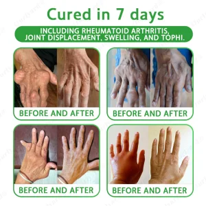 Ourlyard® Advanced Magnesium & Emu Oil Massage Pain Relief Gel 16 Ourlyard® Advanced Magnesium & Emu Oil Massage Pain Relief Gel