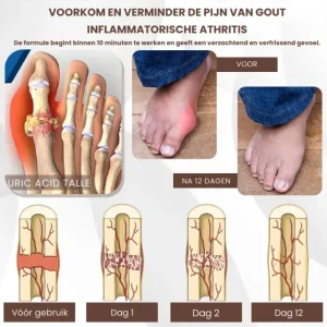 MagniBee™ Joint Support Formula Aerosol | Relieves stiff joints 18 MagniBee™ Joint Support Formula Aerosol | Relieves stiff joints