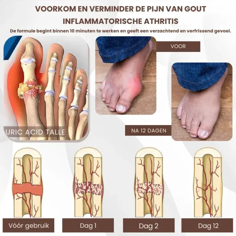 MagniBee™ Joint Support Formula Aerosol | Relieves stiff joints 8 MagniBee™ Joint Support Formula Aerosol | Relieves stiff joints