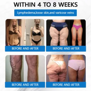 ADFIRE® SMGT-GLP-1 Tirzepatide & Collagen Nano Microneedle Weight Loss Patch