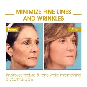Fivfivgo Revitalizing Oil For Skin Tightening