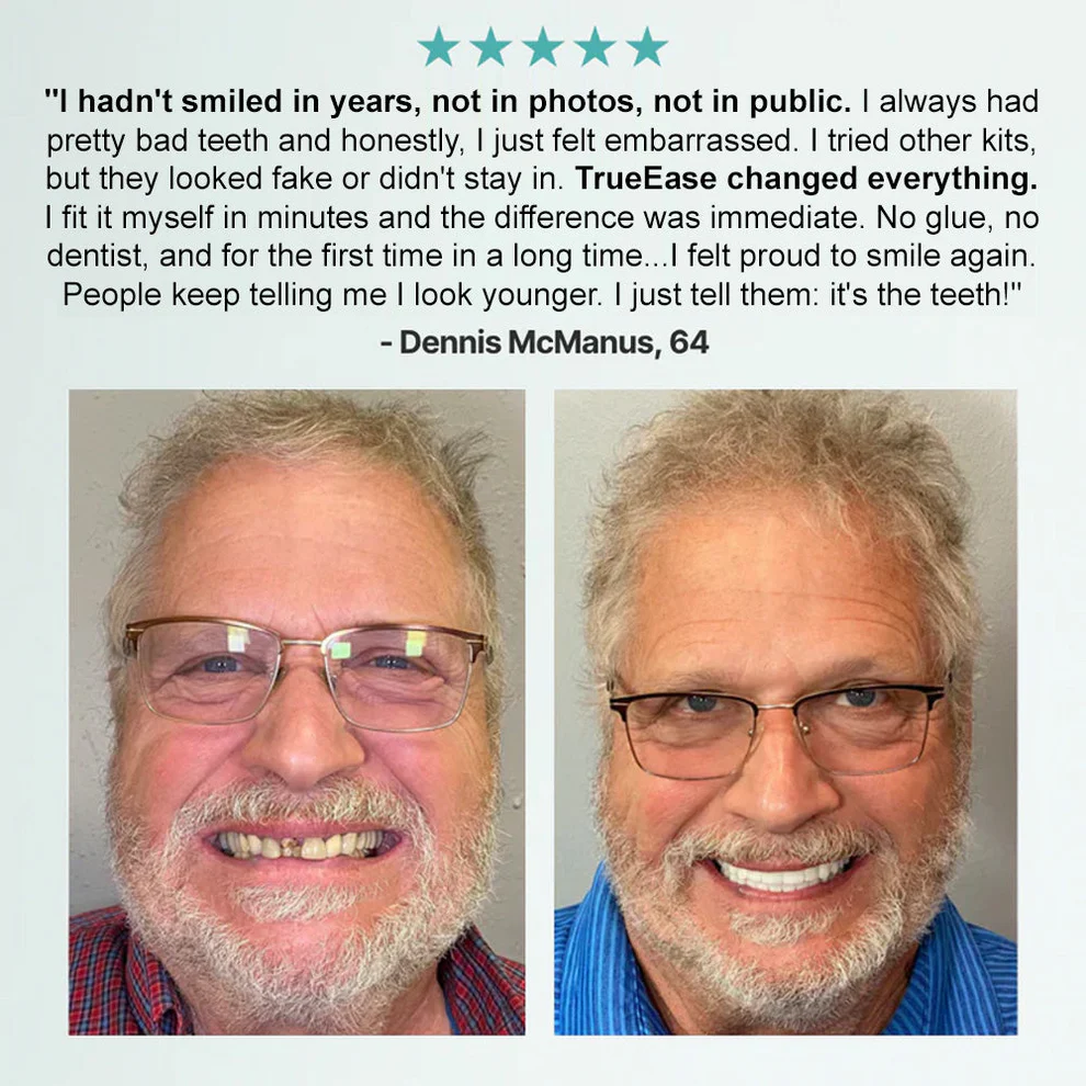 Bikenda®, Advanced Customised Dentures Set 7 Bikenda®, Advanced Customised Dentures Set