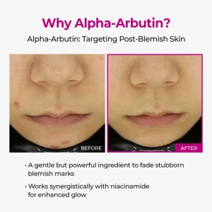 LUHAKA® Pore & Spot Care Duo 15 LUHAKA® Pore & Spot Care Duo