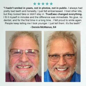 NESLEMY™ Advanced Customized Full Denture Set 14 NESLEMY™ Advanced Customized Full Denture Set