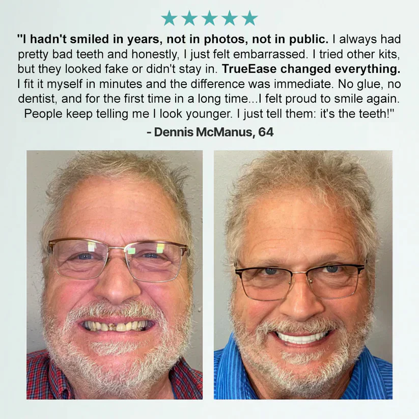 NESLEMY™ Advanced Customized Full Denture Set 6 NESLEMY™ Advanced Customized Full Denture Set