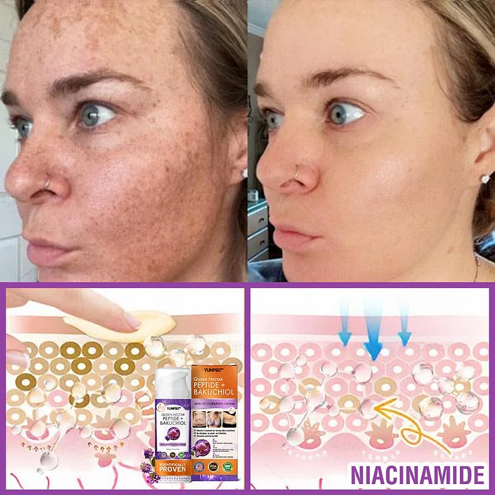 YUNPSO™ Queen Nectar Peptide + Bakuchiol Skin Restoration Cream 6 YUNPSO™ Queen Nectar Peptide + Bakuchiol Skin Restoration Cream
