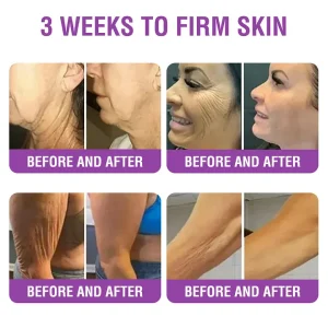 YUNPSO™ Queen Nectar Peptide + Bakuchiol Skin Restoration Cream 22 YUNPSO™ Queen Nectar Peptide + Bakuchiol Skin Restoration Cream