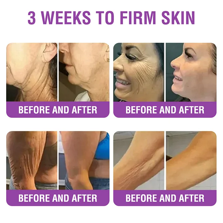 YUNPSO™ Queen Nectar Peptide + Bakuchiol Skin Restoration Cream 5 YUNPSO™ Queen Nectar Peptide + Bakuchiol Skin Restoration Cream