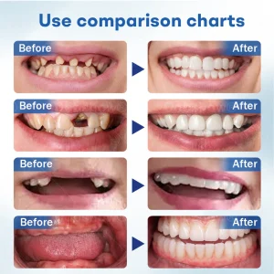 Nurbini® ThermoSeal Fresh Denture 10 Nurbini® ThermoSeal Fresh Denture