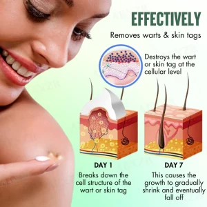 AEXZR® WartsOff Instant Blemish Removal Cream 12 AEXZR® WartsOff Instant Blemish Removal Cream