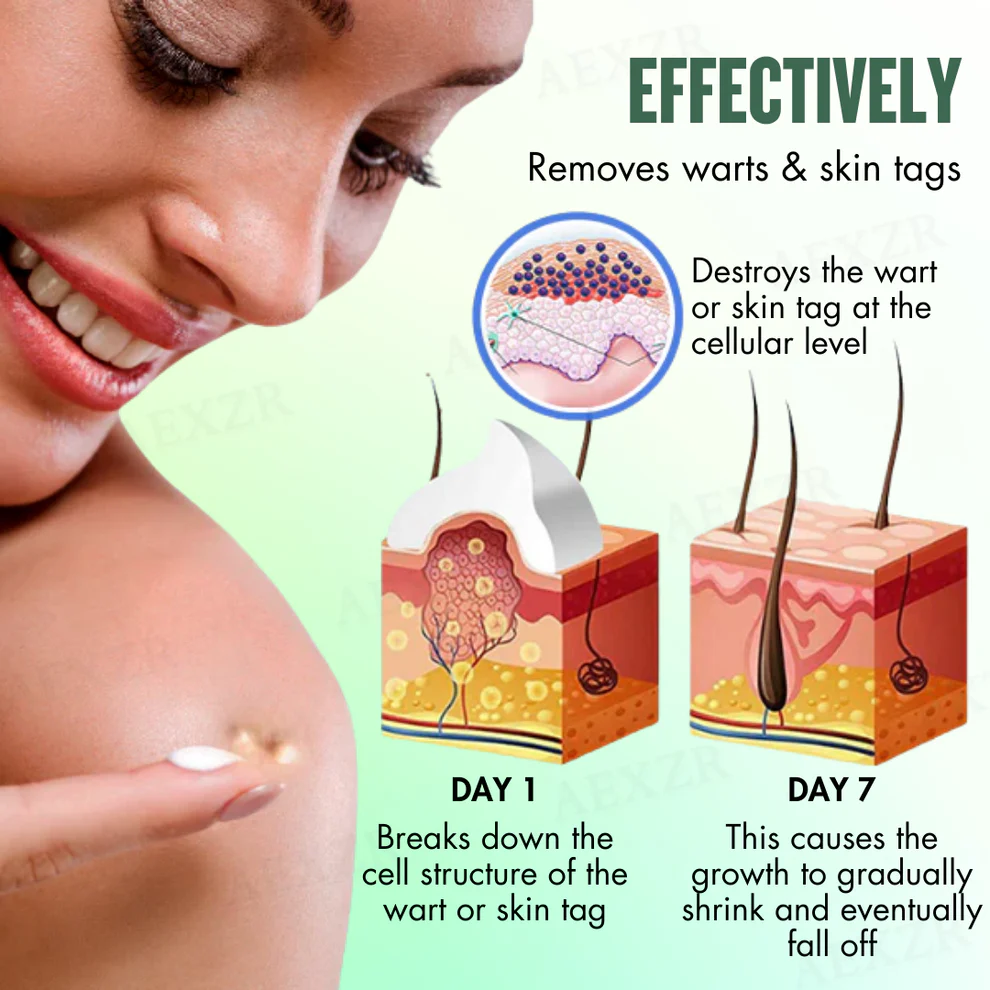 AEXZR® WartsOff Instant Blemish Removal Cream 5 AEXZR® WartsOff Instant Blemish Removal Cream