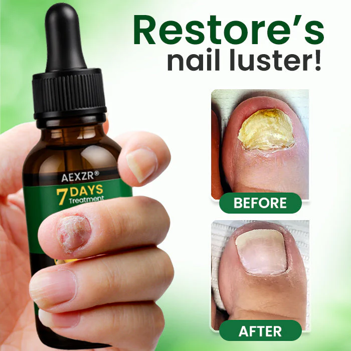 AEXZR® Fungal Nail Treatment 5 AEXZR® Fungal Nail Treatment