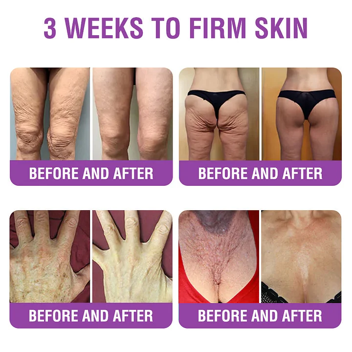 YUNPSO™ Queen Nectar Peptide + Bakuchiol Skin Restoration Cream 4 YUNPSO™ Queen Nectar Peptide + Bakuchiol Skin Restoration Cream