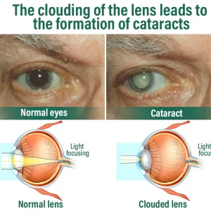 NESLEMY™ Nano Vision Repair Eye Serum 31 NESLEMY™ Nano Vision Repair Eye Serum