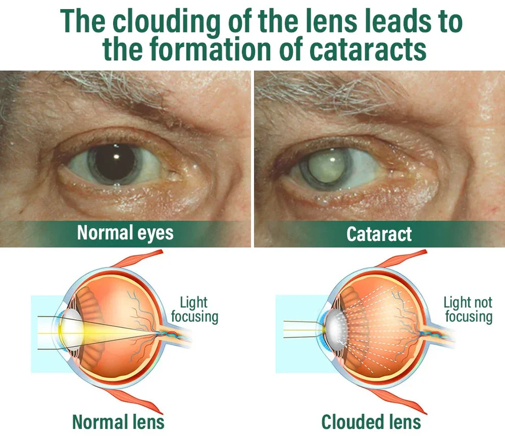 NESLEMY™ Nano Vision Repair Eye Serum 9 NESLEMY™ Nano Vision Repair Eye Serum