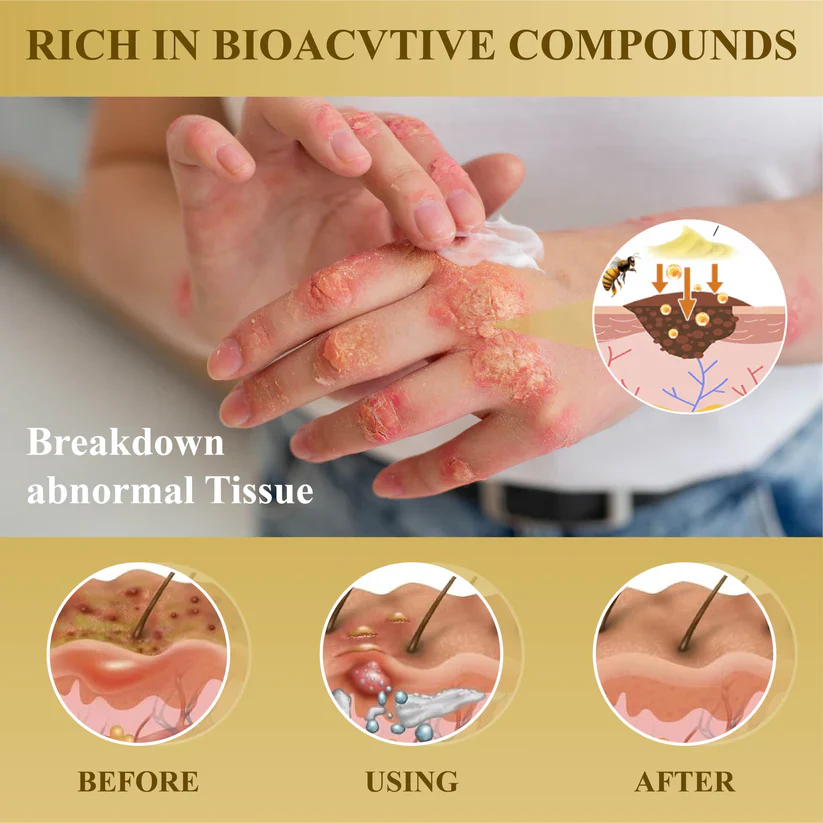 Cvreoz® Condense Mellifera Venom Skin Repairing Cream 8 Cvreoz® Condense Mellifera Venom Skin Repairing Cream - Image 8