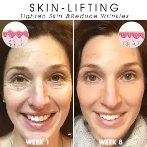 Fivfivgo Revitalizing Oil For Skin Tightening