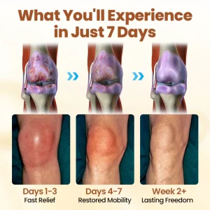 NovaRX® Premium Curcumin Pain Relief Gel 12 NovaRX® Premium Curcumin Pain Relief Gel