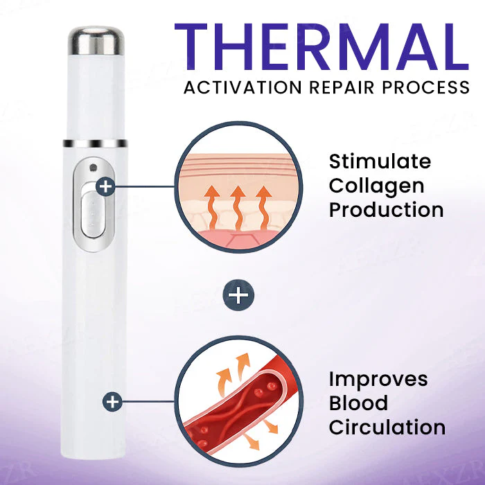 Bikenda® Varicose Vein Photothermal Laser Treatment 4 Bikenda® Varicose Vein Photothermal Laser Treatment