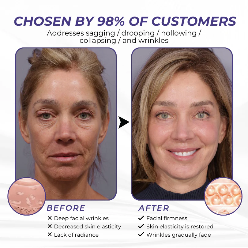 Timilk® ElastaPro Emu Oil Skin Firming Cream 10 Timilk® ElastaPro Emu Oil Skin Firming Cream - Image 10