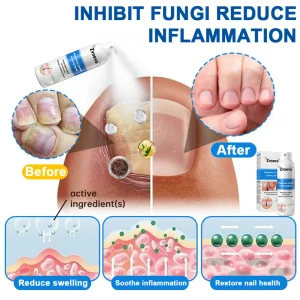 Zvoevo®Magnesium Herbal Psoriasis Spray 20 Zvoevo®Magnesium Herbal Psoriasis Spray