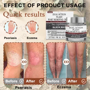 Zvoevo® Black Rice Skin Repair Essence Cream
