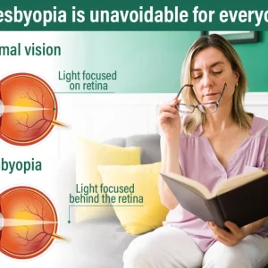 NESLEMY™ Nano Vision Repair Eye Serum 36 NESLEMY™ Nano Vision Repair Eye Serum