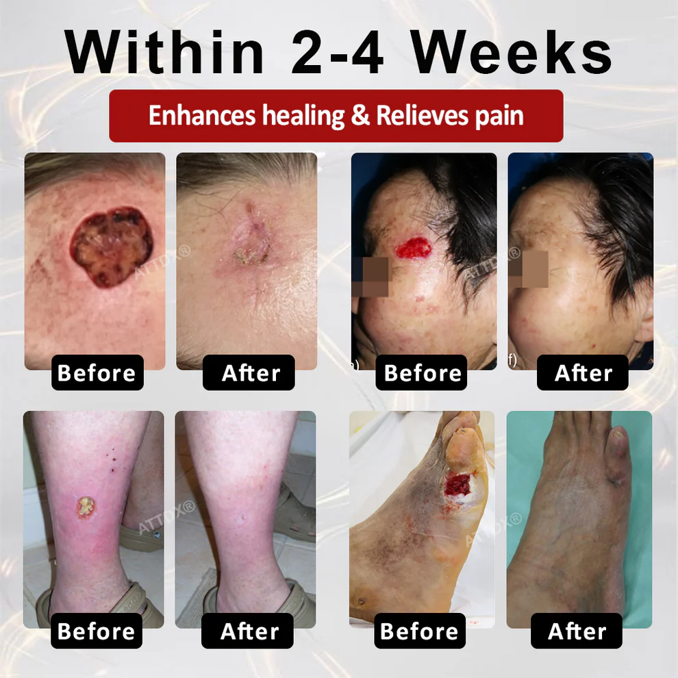 ATTDX® GlucoseGuard Skin Rescue Cream 2 ATTDX® GlucoseGuard Skin Rescue Cream