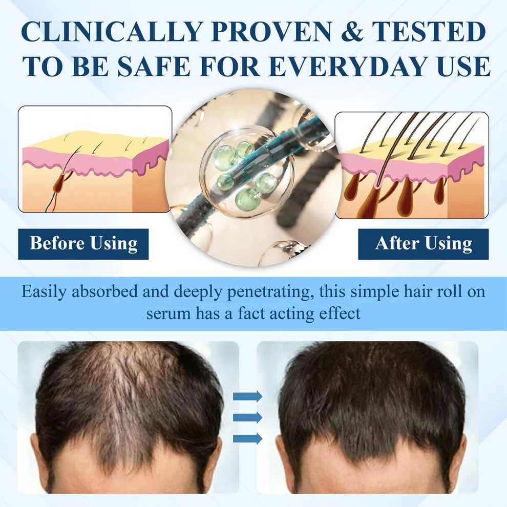 ATTDX® Hair Reawaken PP405 Roll-On Serum 5 ATTDX® Hair Reawaken PP405 Roll-On Serum