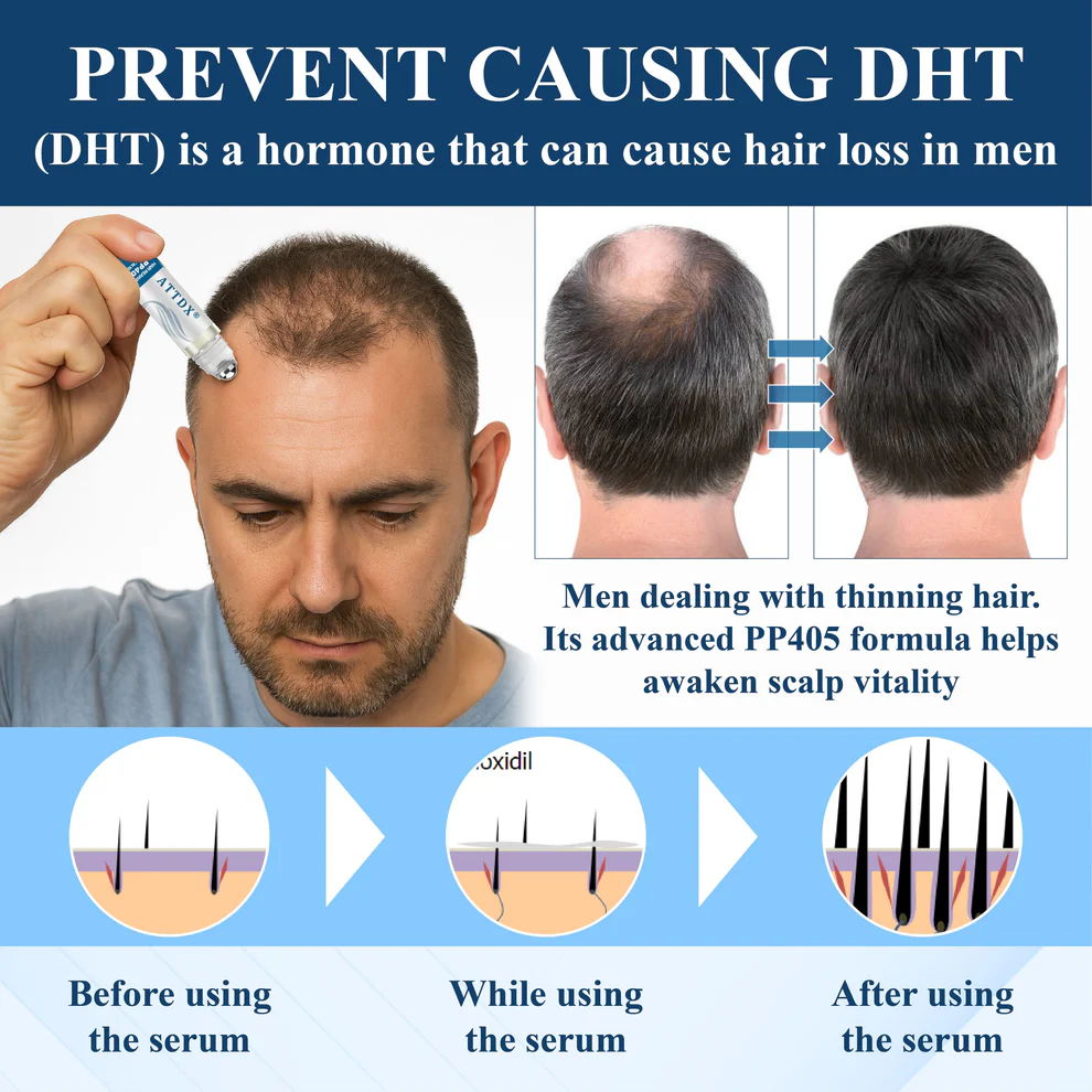 ATTDX® Hair Reawaken PP405 Roll-On Serum 7 ATTDX® Hair Reawaken PP405 Roll-On Serum