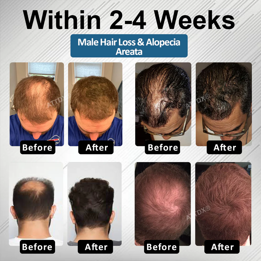 ATTDX® Hair Reawaken PP405 Roll-On Serum 3 ATTDX® Hair Reawaken PP405 Roll-On Serum